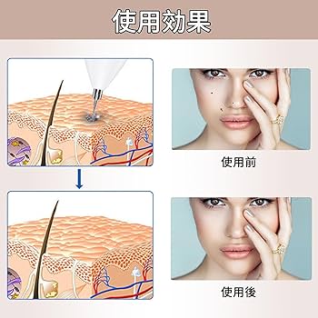 Amazon.co.jp: LEYAQU 美顔器 正規品 家庭用 9段階レベル調節